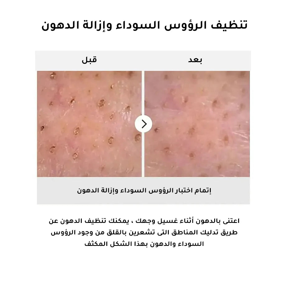 الغسول الزيتي والمنظف الفعال للغاية رقم 1 من نومبوزين - 200 مل